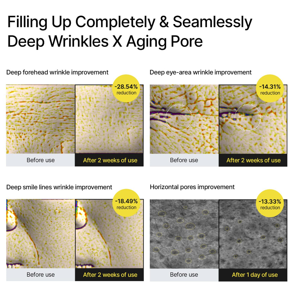 celimax The Vita A Retinal Shot Tightening Booster | 0.1% Retinal, 3% Matryxyl, High-Strength Retinoid for Anti-Aging, Pore Minimizer, Wrinkles & Fine Lines, Firmer Skin