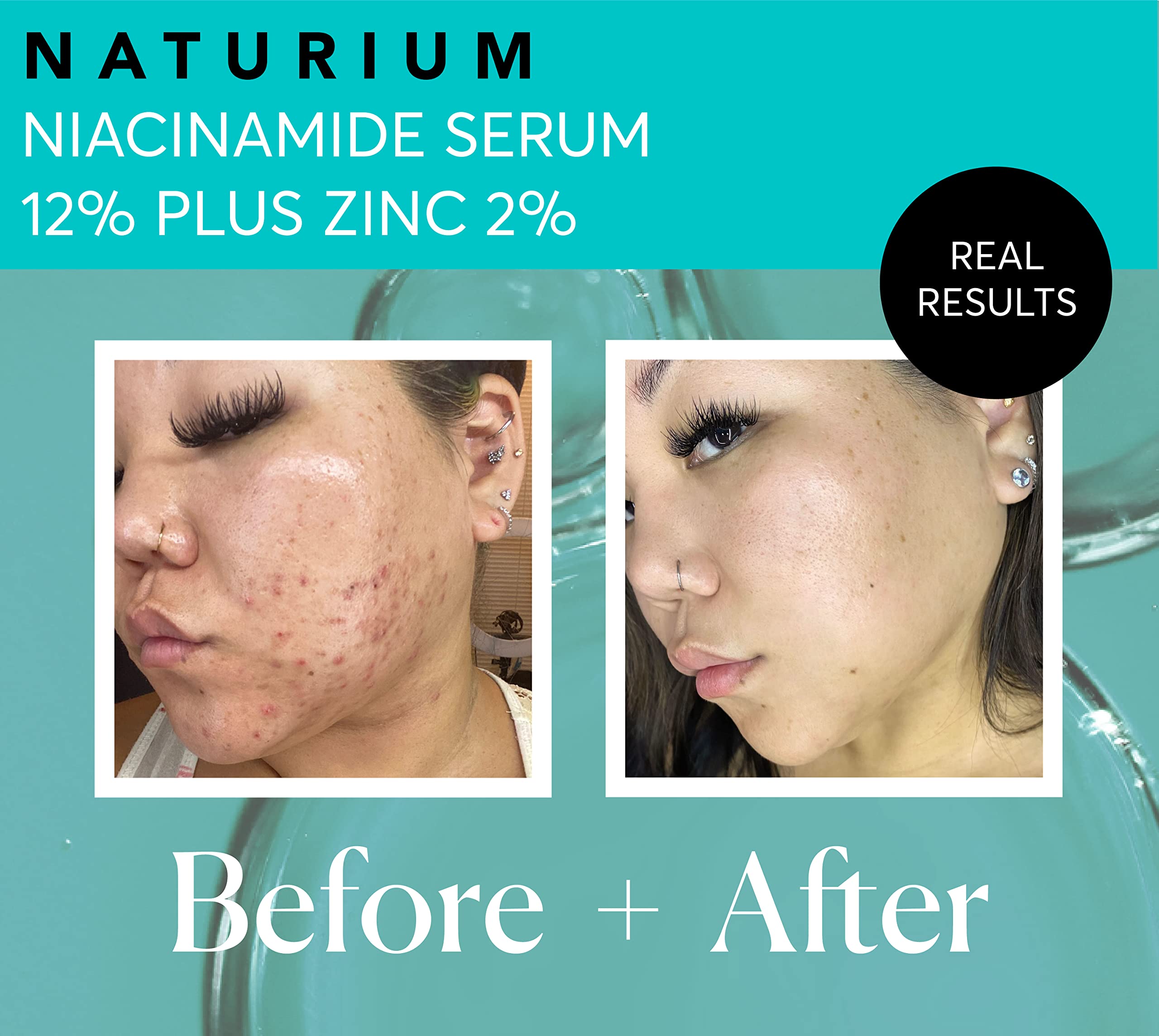 Naturium Niacinamide Face Serum 12% Plus Zinc 2%, Hyaluronic Acid and Vitamin E is a Dark Spot Remover, Pore Minimizer and Aging Skin Treatment
